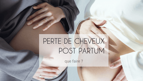 perte de cheveux post partum